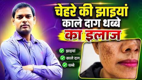 चेहरे की झाइयां काले दाग धब्बों का इलाज ।