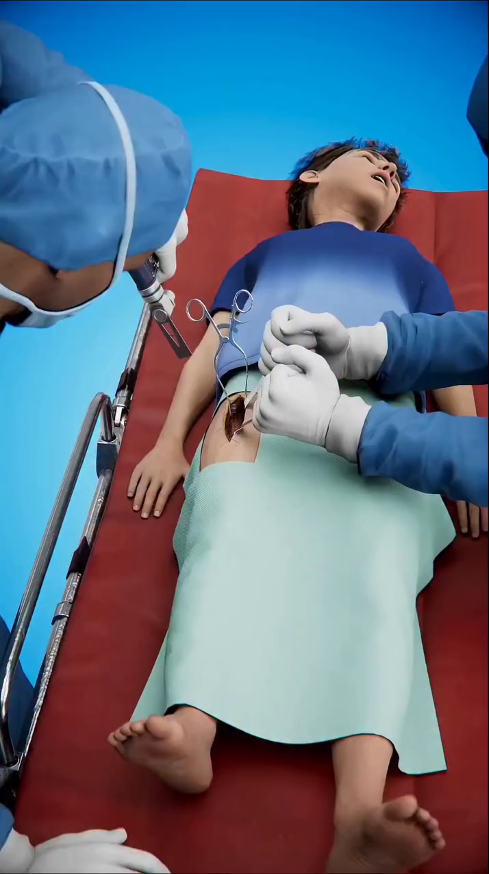 The Surgery That Makes A Leg Longer😮