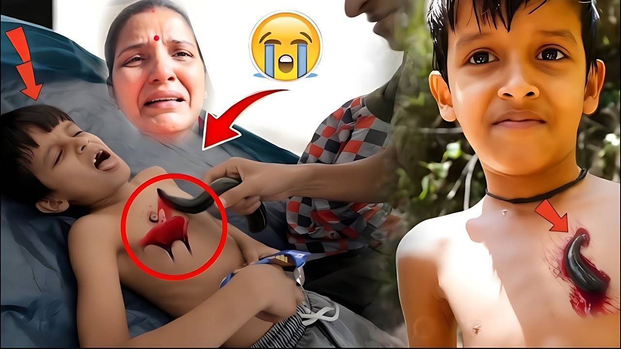 Kunali ko Jungle Mai 😭 Kide ne Kaat Liya