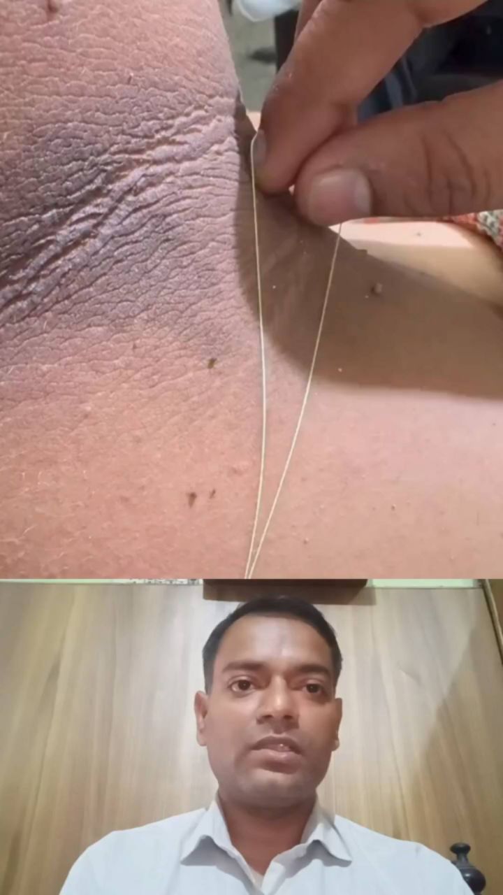 #viral