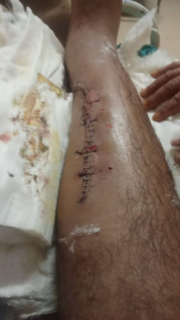 Sad view of hospital j&k